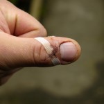 My cut up thumb