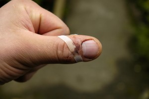 My cut up thumb